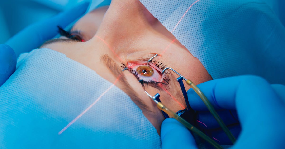 Cận thị cao và cận thị bệnh lý có phẫu thuật bỏ kính được không?